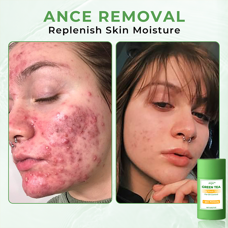 AQA™ Clay Mask Stick