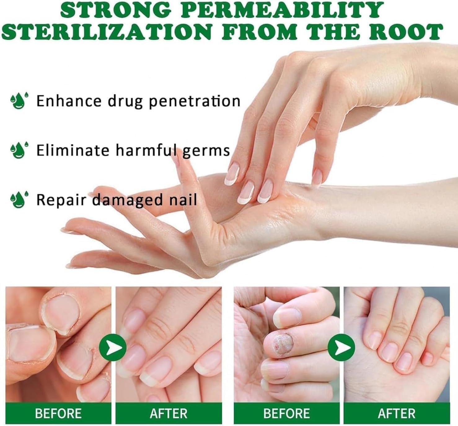 Ginger Nail Revive Nail Care Set