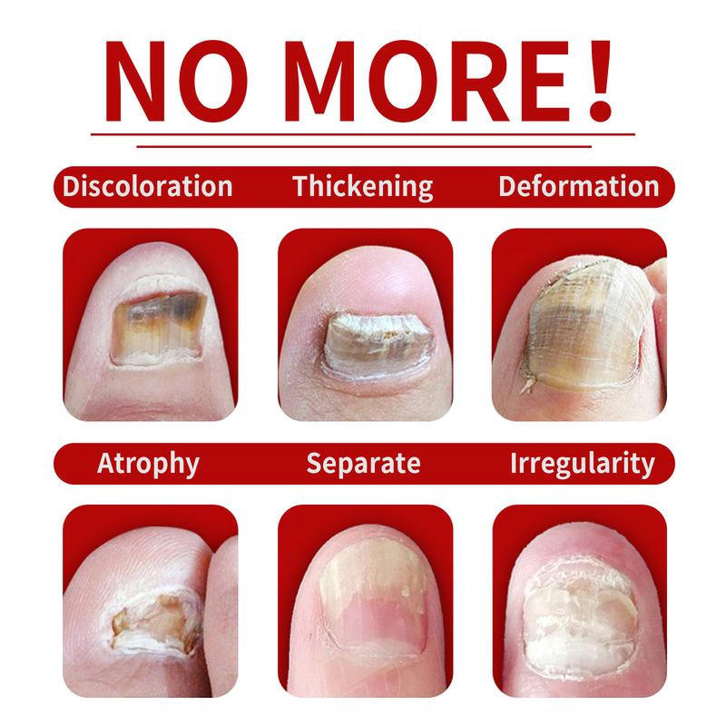 Ginger Nail Revive Nail Care Set