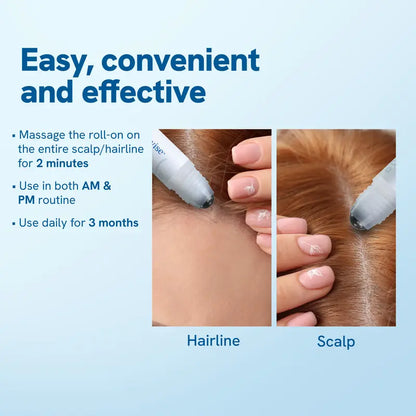 Hair Growth Roll-On Serum – See hair growth in 4 weeks