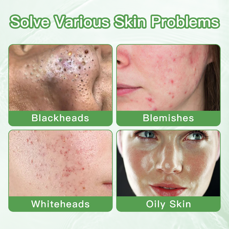 AQA™ Clay Mask Stick