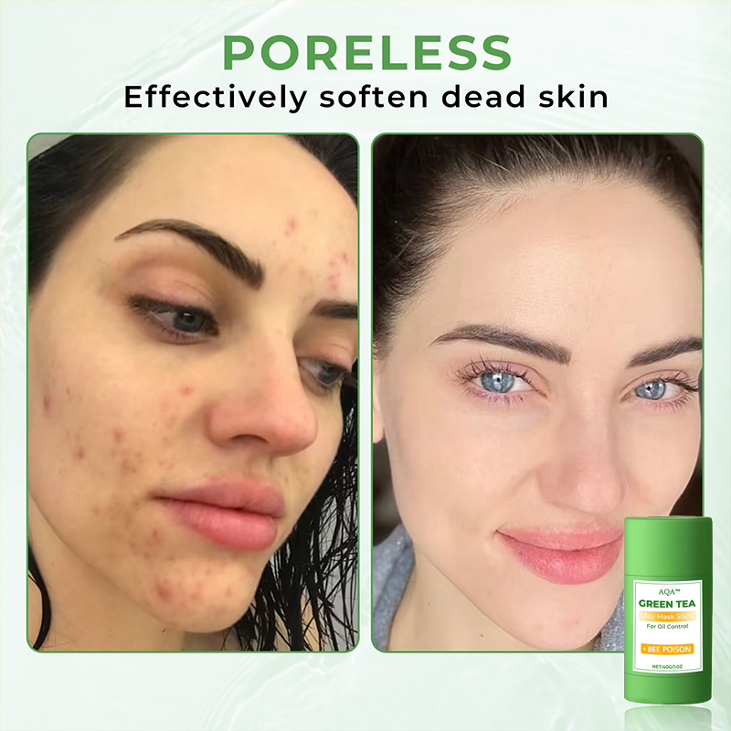 AQA™ Clay Mask Stick