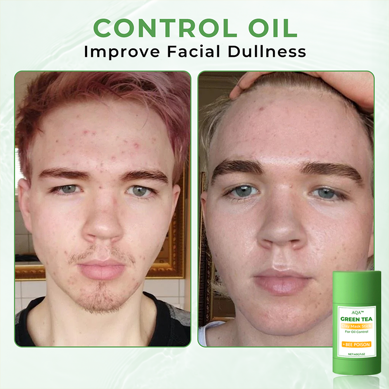 AQA™ Clay Mask Stick